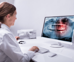 wisdom teeth removal calgary